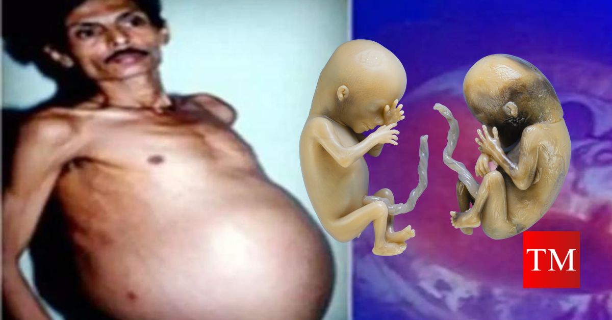 Pregnant man nagpur